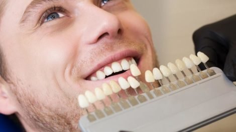 7 Common Errors with Cleaning Dental Implants and How to Avoid Them